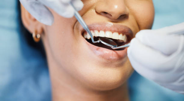 Best Emergency Dental Care for Broken or Chipped Teeth in Clare, MI