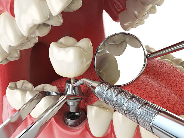 Best Emergency TMJ Treatment in Clare, MI